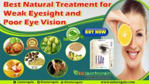 Remedies for Naturally Enhancing Vision 