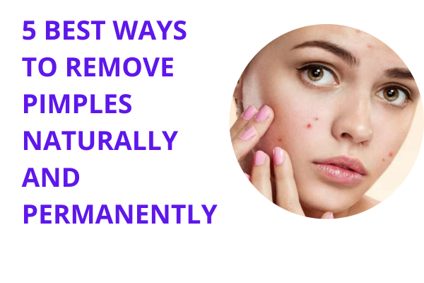 5 Best Ways to Remove Pimples Naturally and Permanently